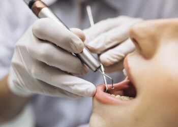 Entre las secuelas del coronavirus están problemas dentales