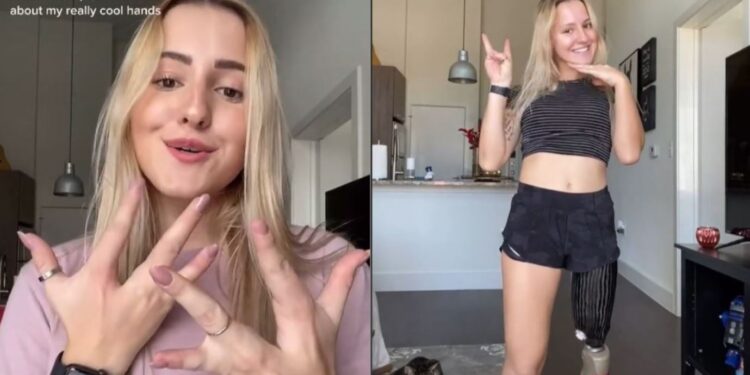 TikTok: Joven comparte cómo es tener que vivir con cuatro dedos en cada mano y una pierna